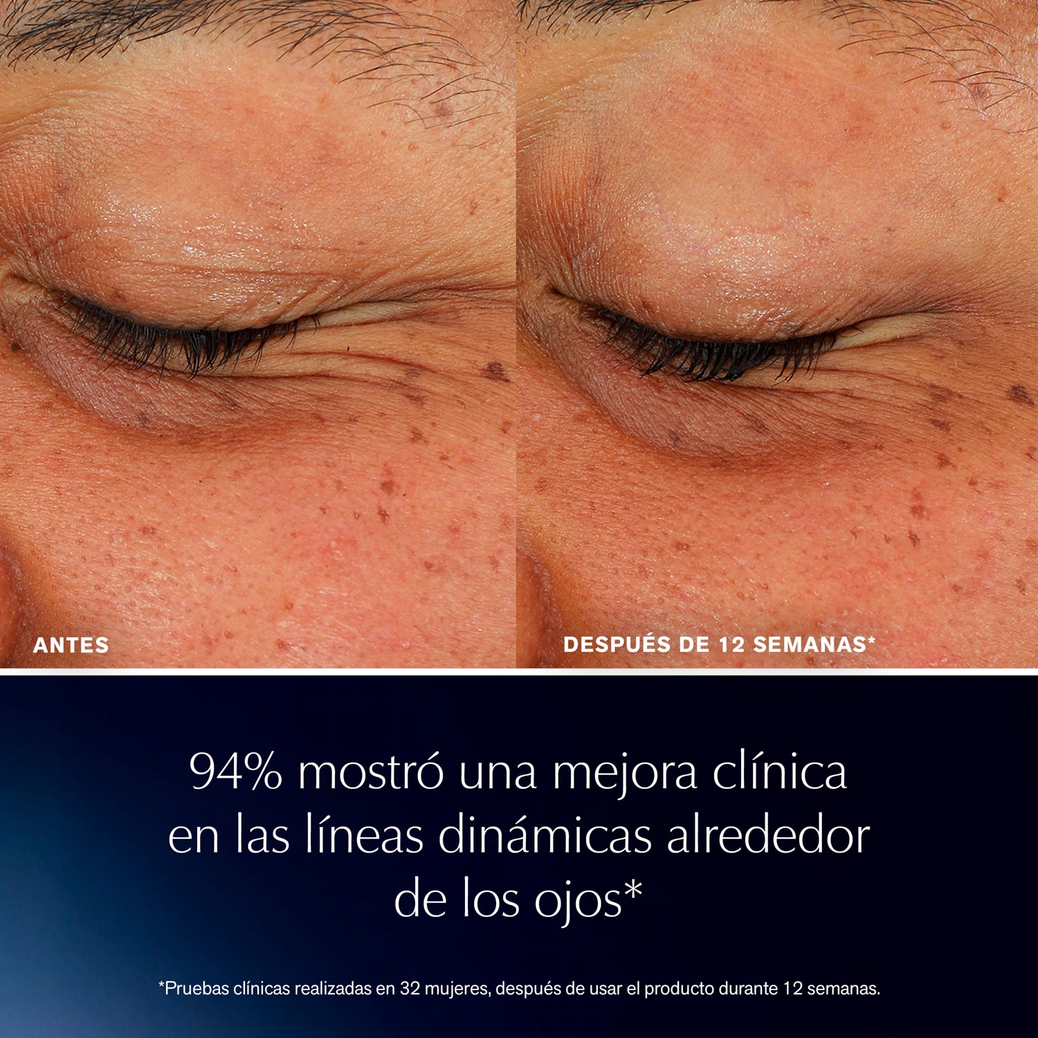ADVANCED NIGHT REPAIR EYE LIFT (SUERO DE OJOS ANTIEDAD)